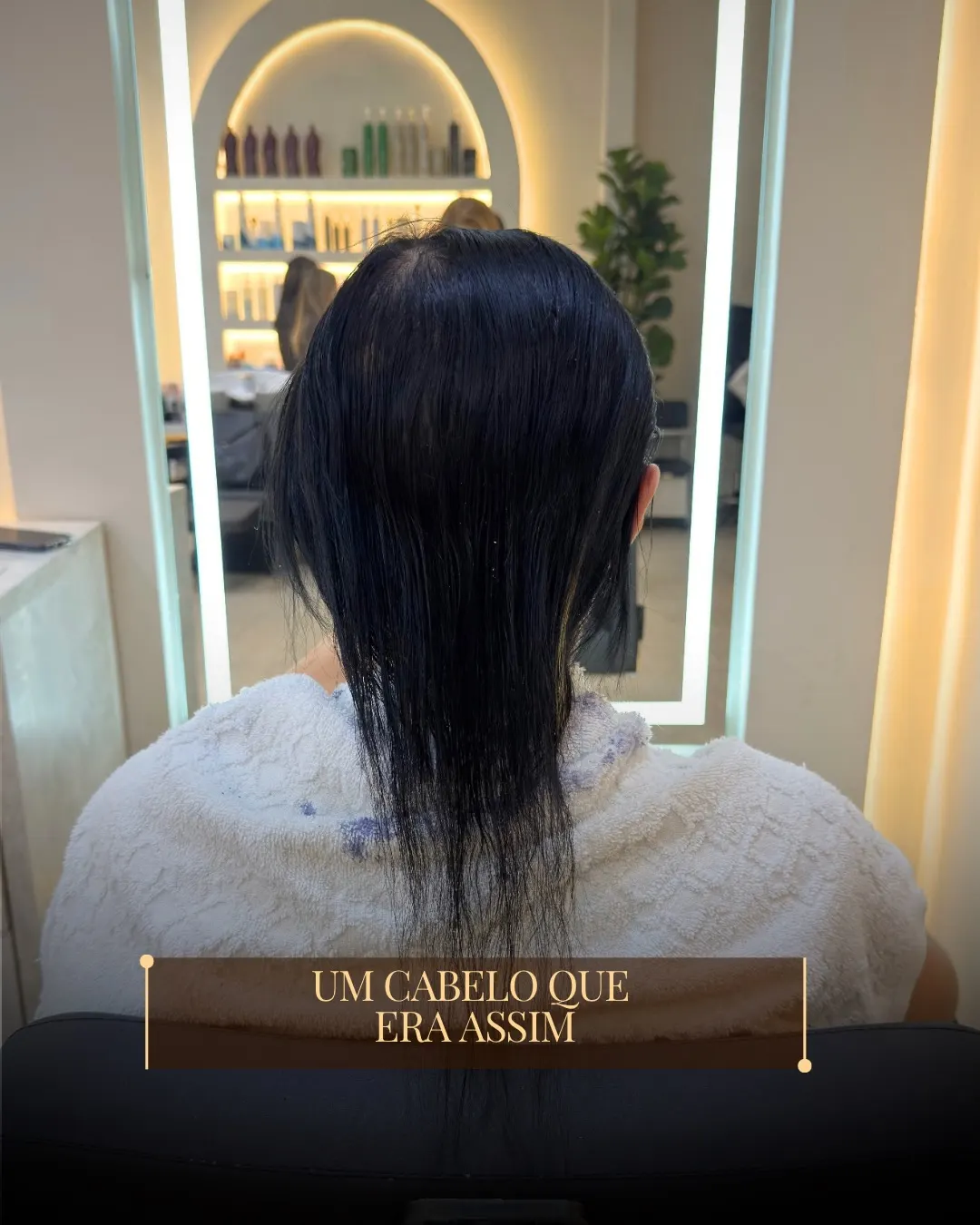 Registro anterior: cabelo curto e fino visto de costas, com texto sobreposto.